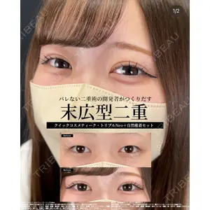 湘南美容クリニック 大阪梅田本院の症例