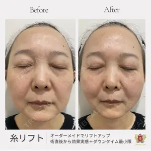 シャトークリニック 河合 秀紀医師の症例