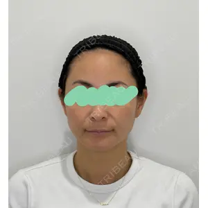 Olivia Clinic 山﨑 香名医師の症例