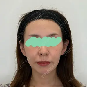 Olivia Clinic 山﨑 香名医師の症例