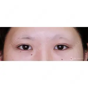 聖心美容クリニック 横浜院 佐々木 直美医師の症例