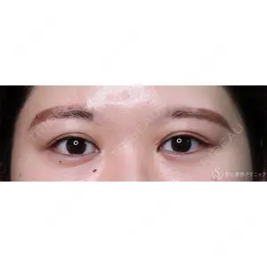 聖心美容クリニック 横浜院 佐々木 直美医師の症例