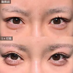 新宿美容外科ネビュラクリニック 山本 紘子医師の症例