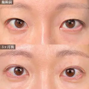 新宿美容外科ネビュラクリニック 山本 紘子医師の症例
