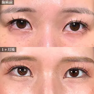 新宿美容外科ネビュラクリニック 山本 紘子医師の症例