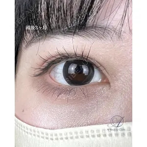 AI Beauty Clinic （エーアイ美容クリニック） 尾崎 宥文医師の症例