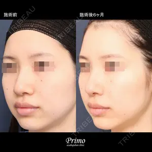 プリモ麻布十番クリニック 大場教弘医師の症例