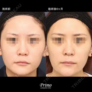 プリモ麻布十番クリニック 大場教弘医師の症例