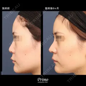 プリモ麻布十番クリニック 大場教弘医師の症例