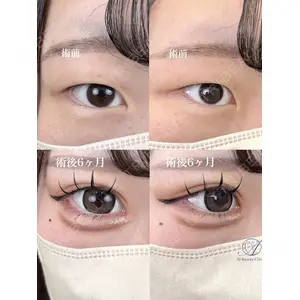 AI Beauty Clinic （エーアイ美容クリニック） 尾崎 宥文医師の症例