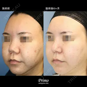 プリモ麻布十番クリニック 大場教弘医師の症例