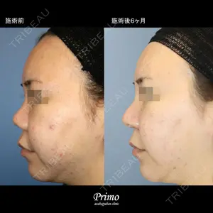 プリモ麻布十番クリニック 大場教弘医師の症例