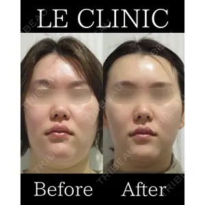 LE CLINIC 喜多　俊博医師の症例