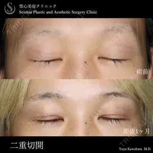 聖心美容クリニック 銀座院 川端 優也医師の症例