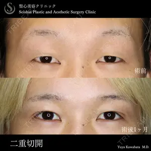 聖心美容クリニック 銀座院 川端 優也医師の症例