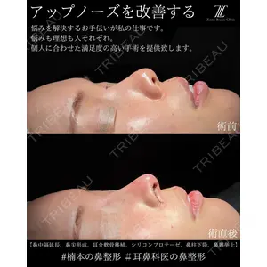 Zetith Beauty Clinic 大阪心斎橋院 楠本 拓哉医師の症例