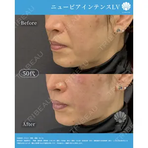 LA MER CLINIC 辻 航平医師の症例