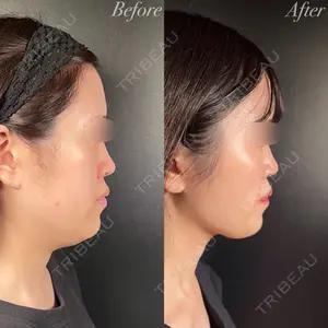 R Beauty CLINIC 銀座院 中西 友莉医師の症例