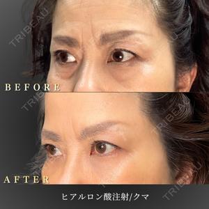 BiBiクリニック 山本 幸一郎医師の症例