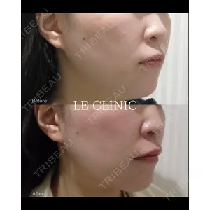 LE CLINICの症例