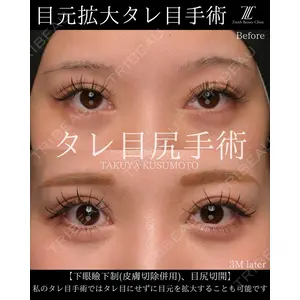 Zetith Beauty Clinic 大阪心斎橋院 楠本 拓哉医師の症例