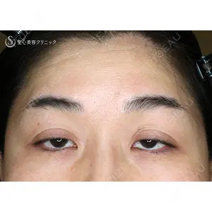 聖心美容クリニック 札幌院 前多 一彦医師の症例