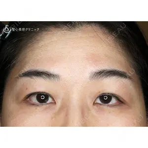 聖心美容クリニック 札幌院 前多 一彦医師の症例