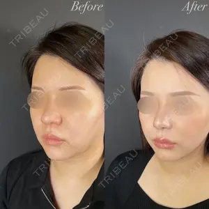 R Beauty CLINIC 大阪院 小池 泰弘医師の症例