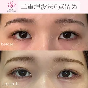 オーキッド美容クリニック東京御徒町 西浦 蘭子医師の症例