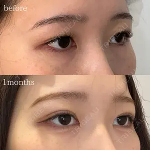 オーキッド美容クリニック東京御徒町 西浦 蘭子医師の症例