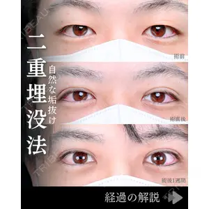 東京シンデレラ美容外科 池袋院 石井 達也医師の症例