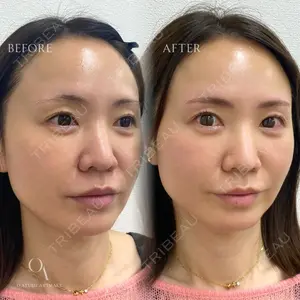 muni skin clinicの症例