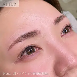 muni skin clinicの症例