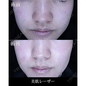 HAAB×DREAM BEAUTY CLINIC 大阪梅田院の症例