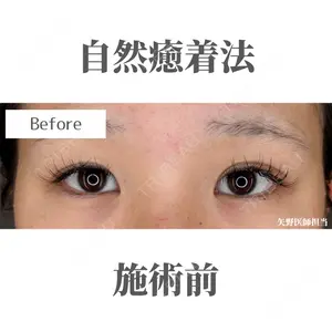 Belle Via Clinic 矢野翼医師の症例