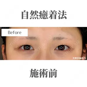 Belle Via Clinic 矢野翼医師の症例