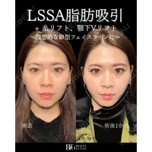 BITO BEAUTY CLINIC 伊藤 富良野医師の症例
