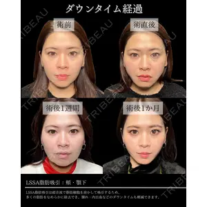 BITO BEAUTY CLINIC 伊藤 富良野医師の症例