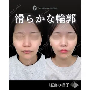 東京シンデレラ美容外科 池袋院 石井 達也医師の症例