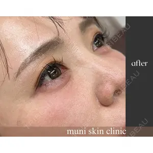 muni skin clinicの症例