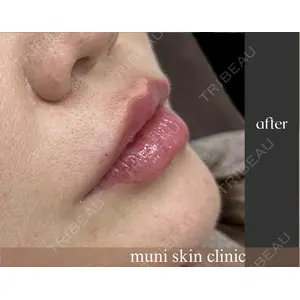 muni skin clinic 高麗 惠理医師の症例