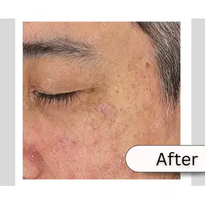 muni skin clinic 高麗 惠理医師の症例