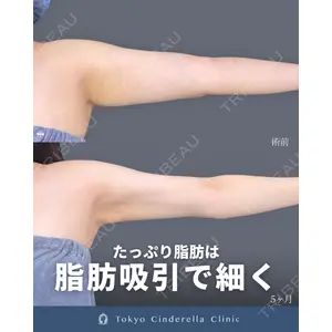 東京シンデレラ美容外科 新宿院 吉原 伯医師の症例