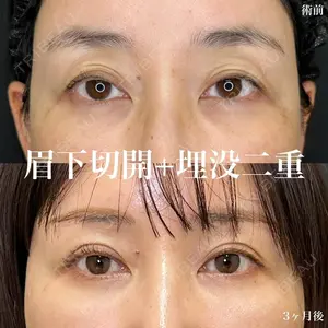 ルラ美容クリニック 名古屋栄院 / ルラスキンクリニック 名古屋栄院 関戸 優医師の症例