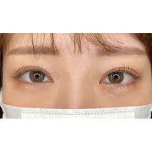NEXUS CLINIC 酒井　知子医師の症例