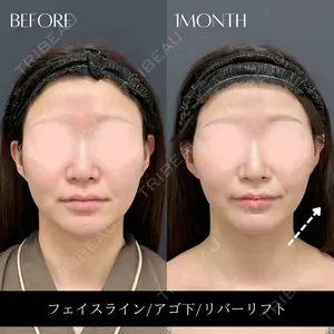 RIVER CLINIC（リバークリニック）の症例