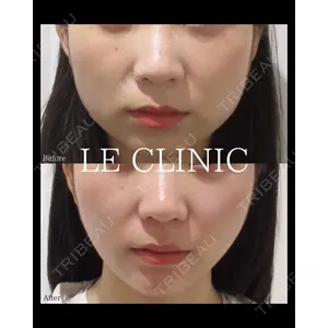 LE CLINICの症例