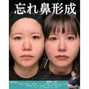 Zetith Beauty Clinic 銀座院 小川 悟史医師の症例