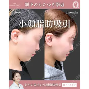 東京シンデレラ美容外科 池袋院 梅田 絢乃医師の症例