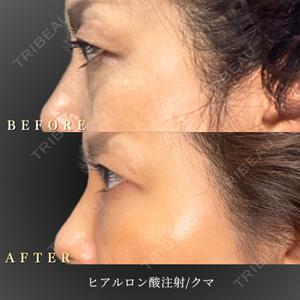 BiBiクリニック 山本 幸一郎医師の症例
